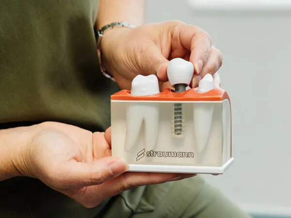 Dental Implants at Toftwood Dental