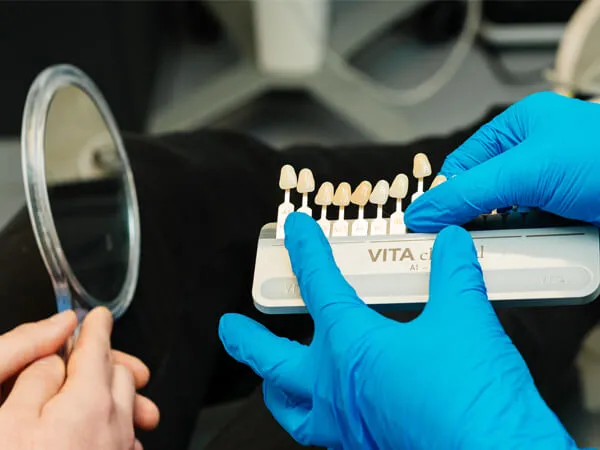 Veneers at Toftwood Dental